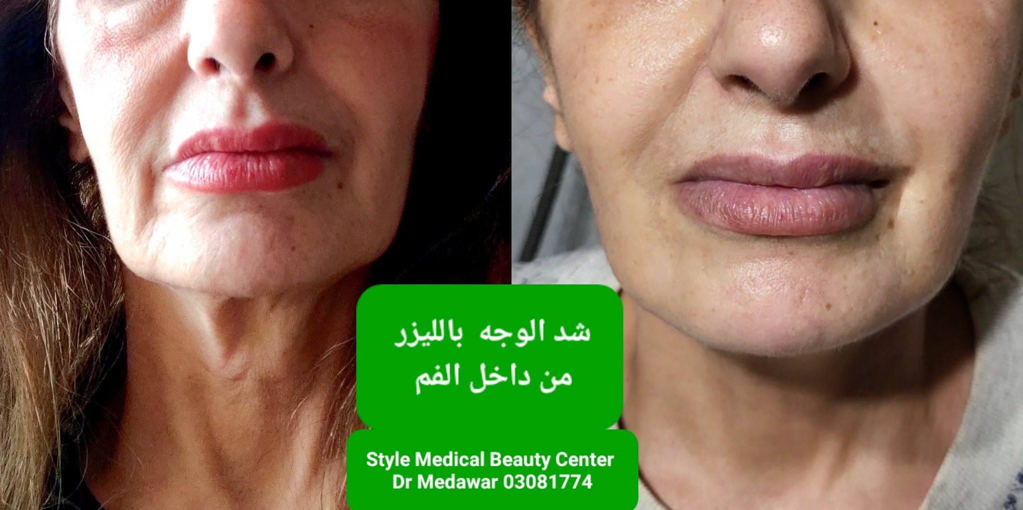 Dr Emile Medawar Aesthetic Laser Treatment