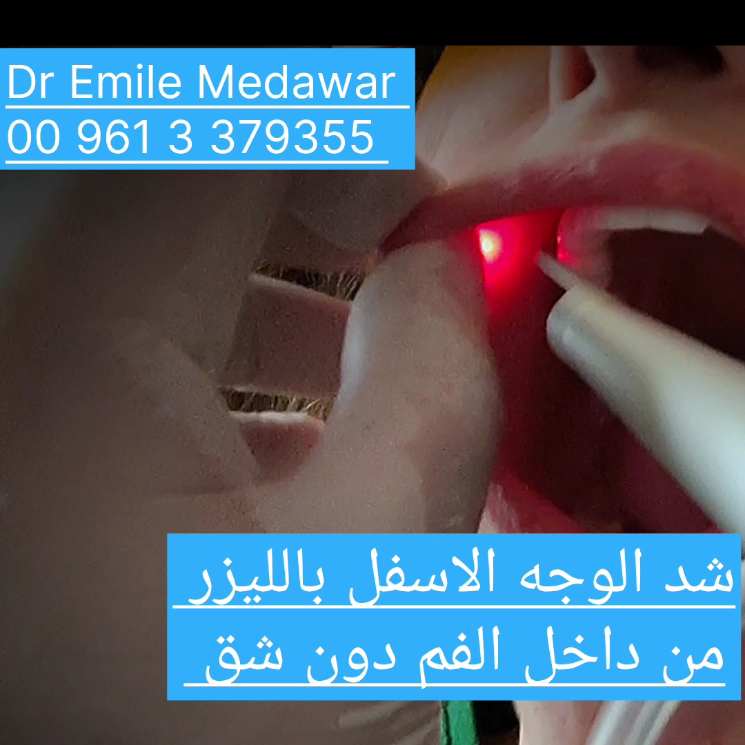Non Surgical Laser Face Tightening Lebanon