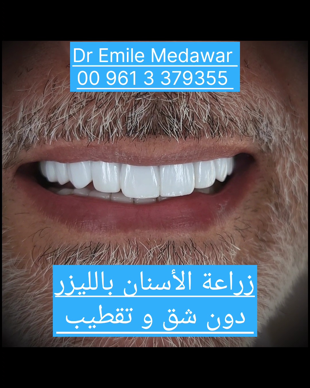 Modern Dental Implant Technology