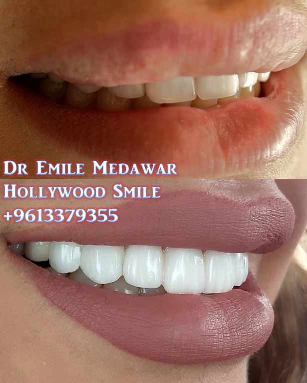 عيادة تجميل الأسنان في بيروت